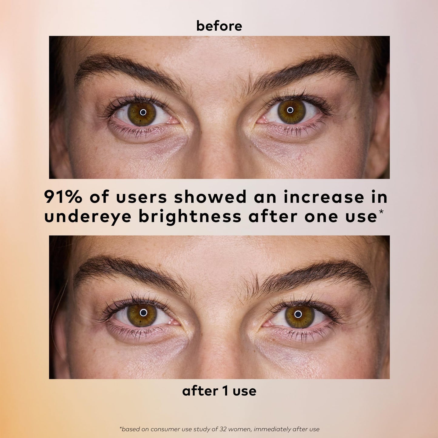 The Good Patch Brighten Up Hydrogel Under Eye Patches for Dark Circles and Puffy Eyes, Made with Niacinamide, Vitamin K, Pine Leaf Extract, Clinically Proven (18 Total Patch Sets)