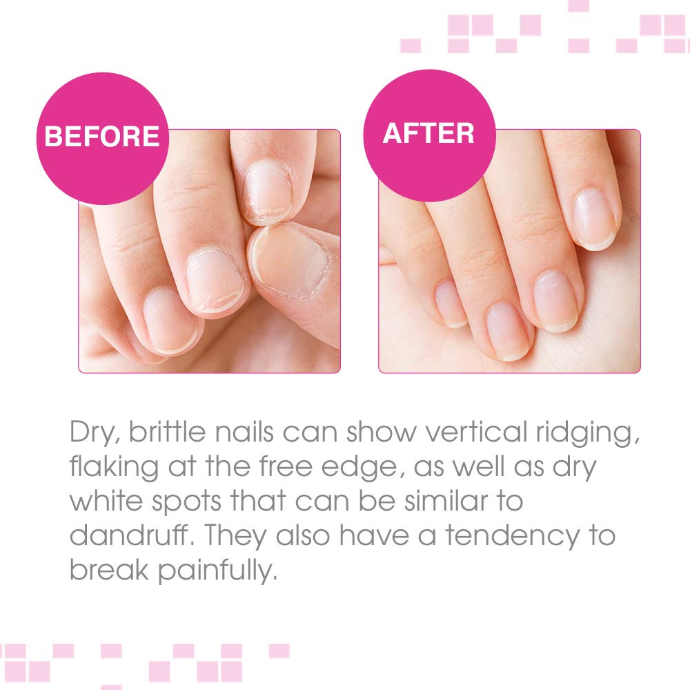 Nail Tek Protection Plus 3, Nail Strengthener for Hard and Brittle Nails, 0.5 oz, 1-Pack